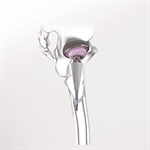 شورت استم بدون سیمان متا