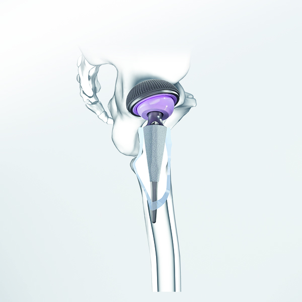 شورت استم بدون سیمان متا